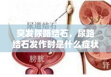 突發(fā)尿路結(jié)石，尿路結(jié)石發(fā)作時是什么癥狀? 