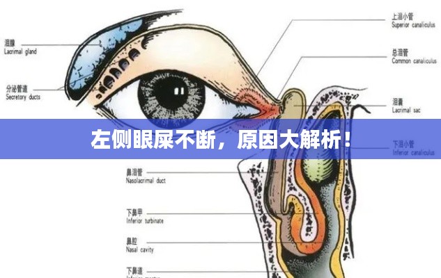 左側(cè)眼屎不斷，原因大解析！