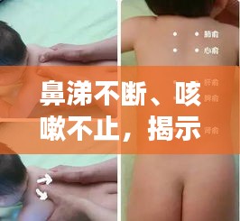 鼻涕不斷、咳嗽不止，揭示癥狀背后的健康隱患