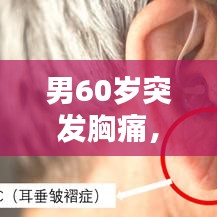 男60歲突發(fā)胸痛，癥狀、原因解析與緊急應(yīng)對(duì)措施