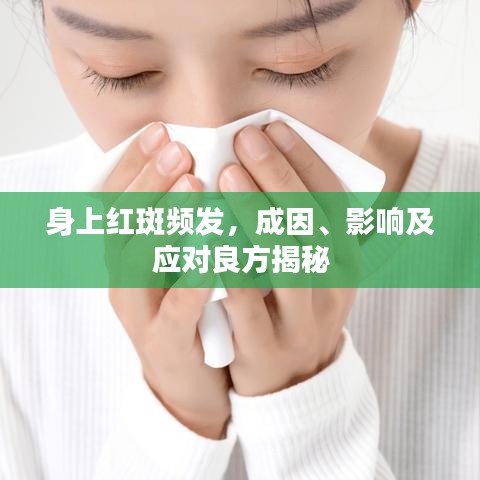 身上紅斑頻發(fā)，成因、影響及應對良方揭秘