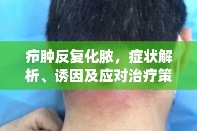 癤腫反復(fù)化膿，癥狀解析、誘因及應(yīng)對(duì)治療策略