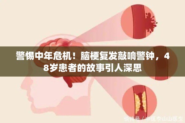 警惕中年危機(jī)！腦梗復(fù)發(fā)敲響警鐘，48歲患者的故事引人深思